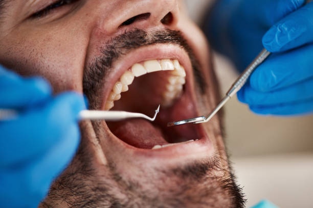 Best Chipped Tooth Repair Near Me  in Poydras, LA